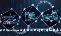 如何解决Tokenim币未显示的问题：详细指导与技巧